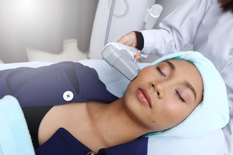 Beautifill laser treatments in Ohio